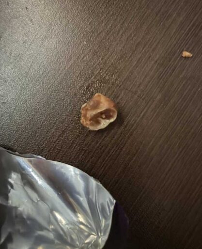 ロッテチョコパイ 歯