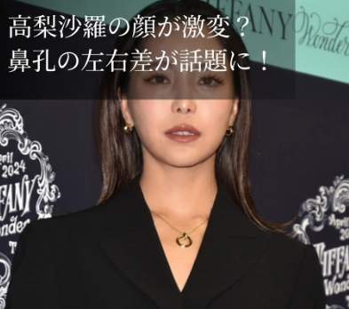 高梨沙羅の顔が変わりすぎ？鼻孔の左右差に整形疑惑が浮上！