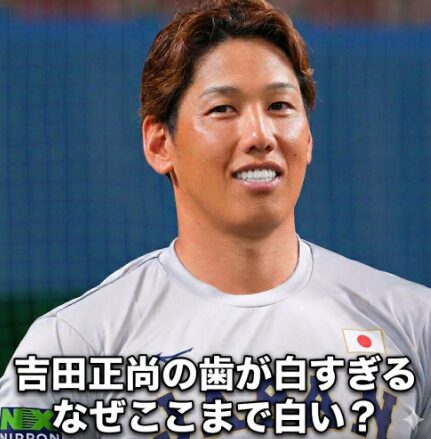 吉田正尚 歯の白さ
